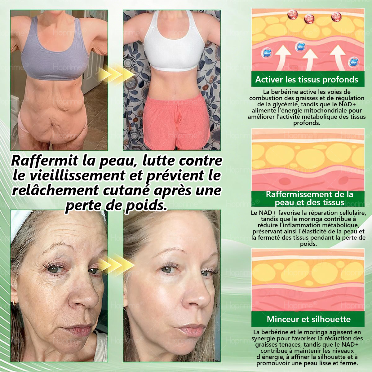 Boutique Officielle | 💎💎 𝑯𝙤𝒑𝐫𝒊𝙢𝒆® 𝑴𝒐𝒓𝒊𝒏𝒈𝗮 · 𝗕𝗲𝗿𝗯𝗲𝗿𝙞𝙣𝙚 × 𝙉𝐀𝐃+ 10-en-1 Patch Nano Microneedle Avancé 🇨🇦 (Une seule application par jour, changements visibles en 7 jours) ✅ Pour l’obésité, la peau relâchée, le diabète, l’apnée du sommeil